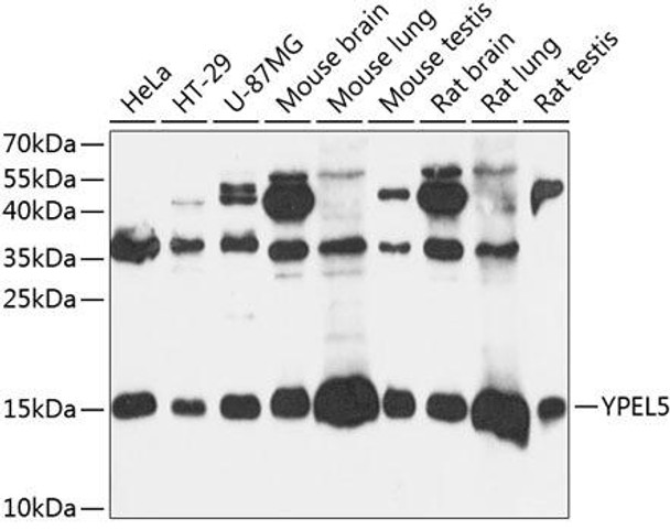 Anti-YPEL5 Antibody (CAB14331)