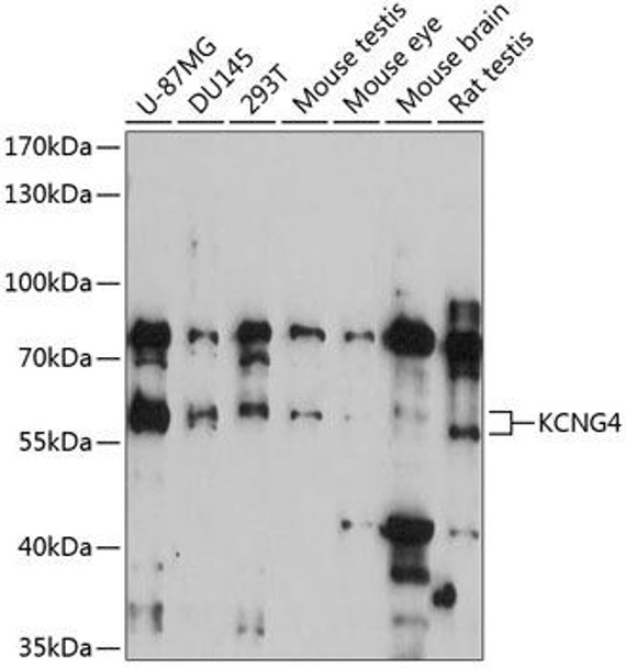 Anti-KCNG4 Antibody (CAB14435)