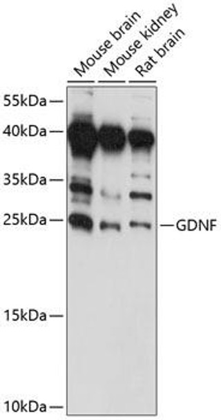 Anti-GDNF Antibody (CAB14639)