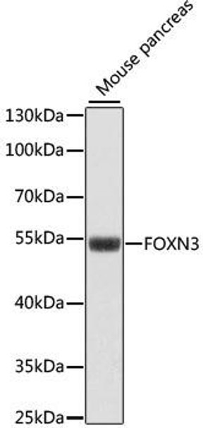 Anti-FOXN3 Antibody (CAB15039)