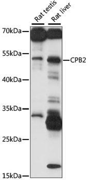 Anti-CPB2 Antibody (CAB15266)