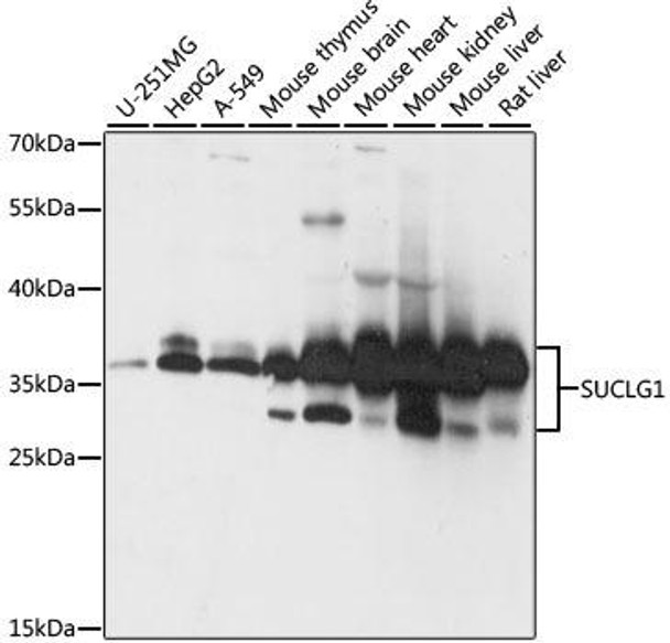 Anti-SUCLG1 Antibody (CAB15345)