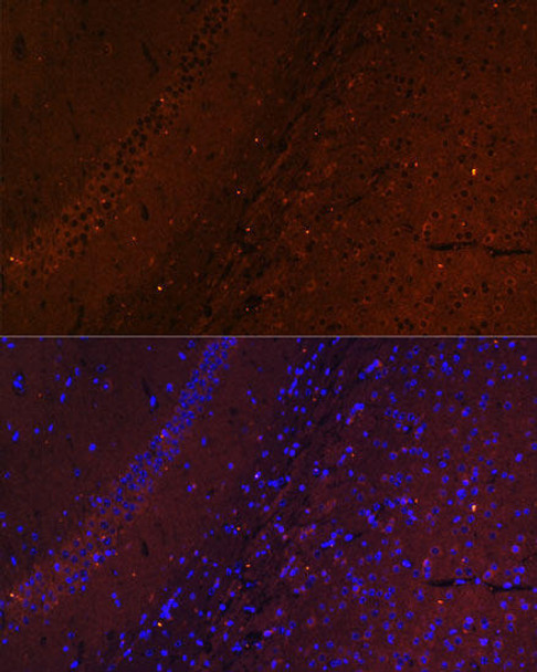 Anti-RUSC1 Antibody (CAB15417)