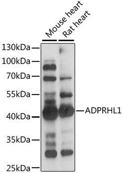 Anti-ADPRHL1 Antibody (CAB15553)