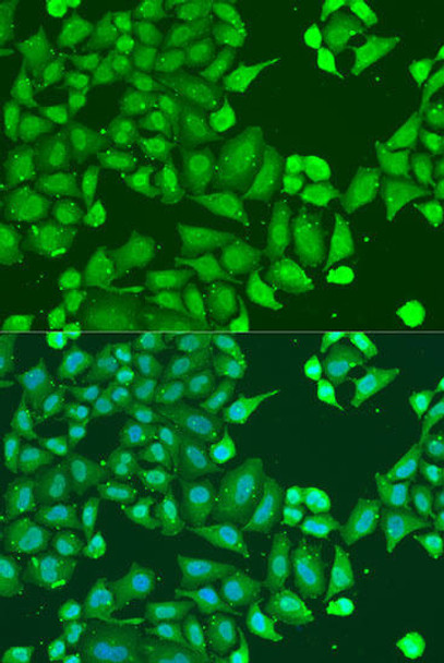 Anti-GNAI3 Antibody (CAB15674)