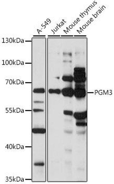 Anti-PGM3 Antibody (CAB15699)