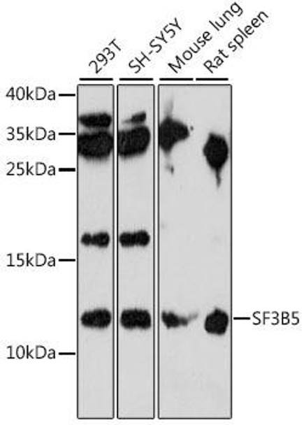 Anti-SF3B5 Antibody (CAB15905)