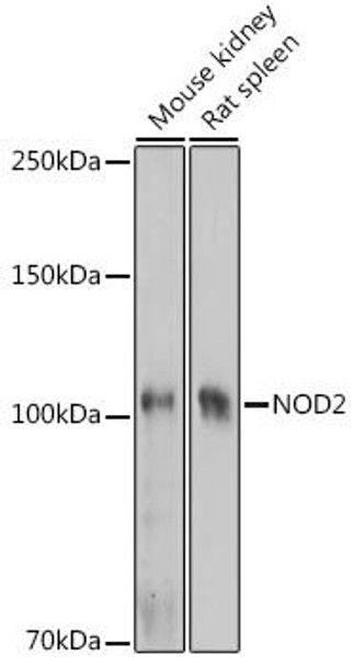 Anti-NOD2 Antibody (CAB15992)