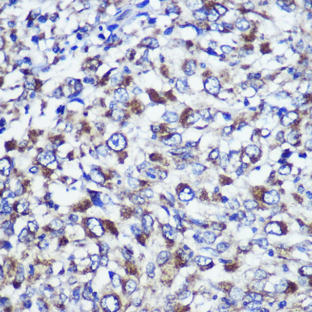 Anti-DIS3L Antibody (CAB16160)