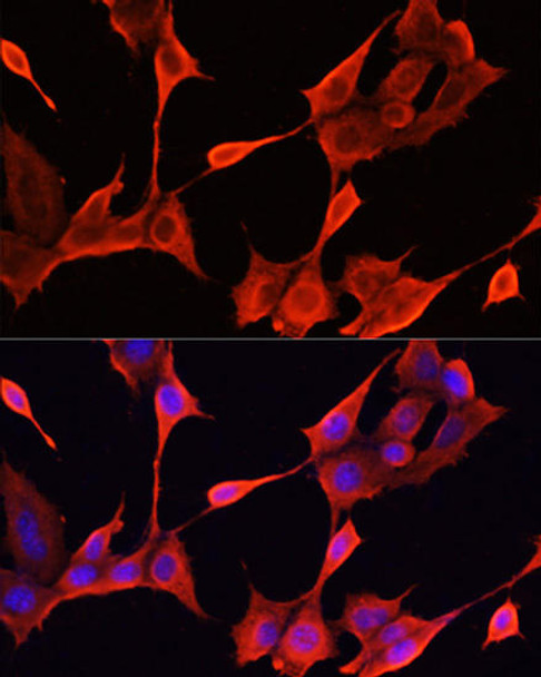 Anti-KRT1 Antibody (CAB16275)