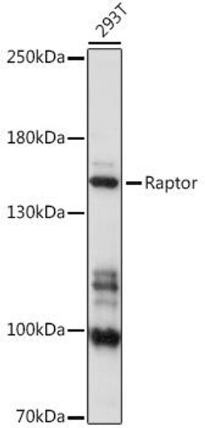 Anti-Raptor Antibody (CAB16309)