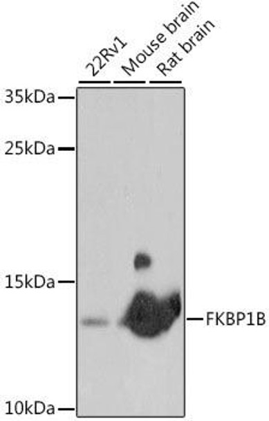 Anti-FKBP1B Antibody (CAB16375)