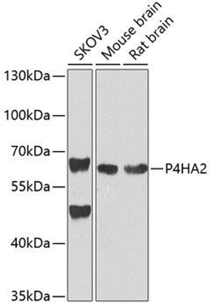 Anti-P4HA2 Antibody (CAB4262)