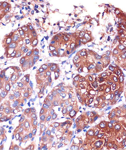 Anti-LYPLA1 Antibody (CAB4419)