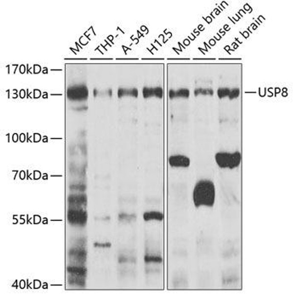 Anti-USP8 Antibody (CAB7031)