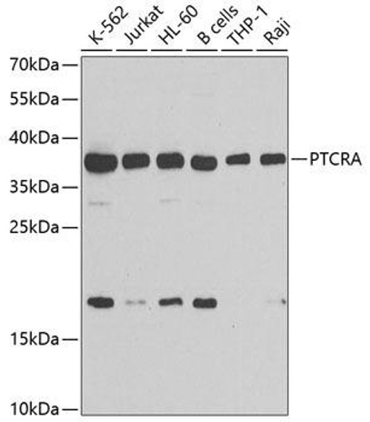 Anti-PTCRA Antibody (CAB7150)