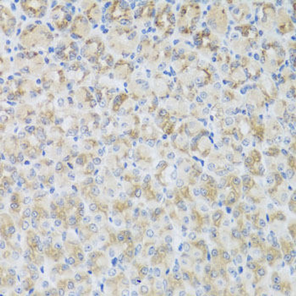 Anti-ARFGAP3 Antibody (CAB8204)