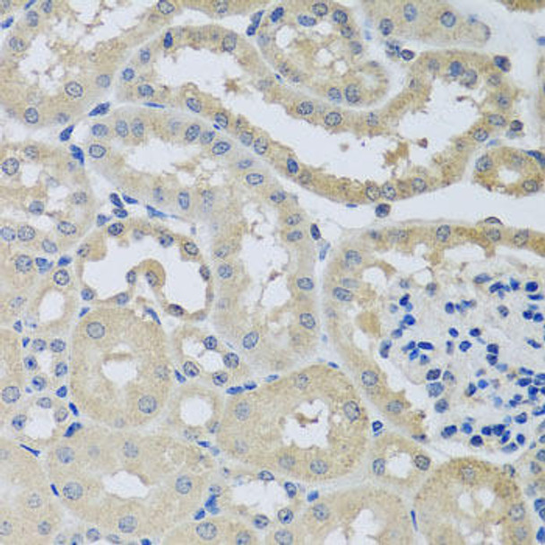 Anti-CHMP1B Antibody (CAB8239)