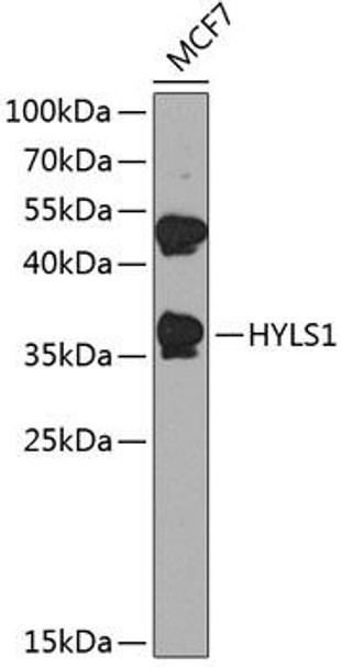 Anti-HYLS1 Antibody (CAB8285)