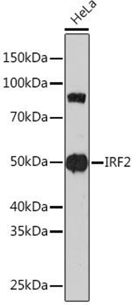 Anti-IRF2 Antibody (CAB4843)