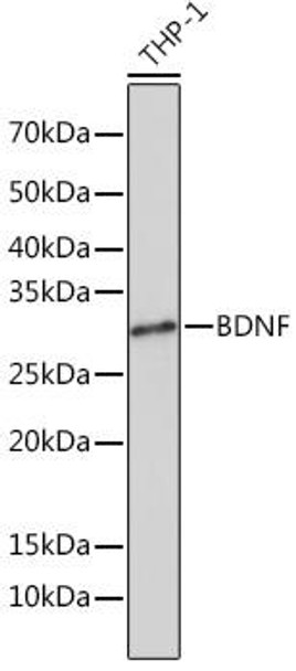 Anti-BDNF Antibody (CAB4873)