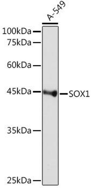 Anti-SOX1 Antibody (CAB5949)