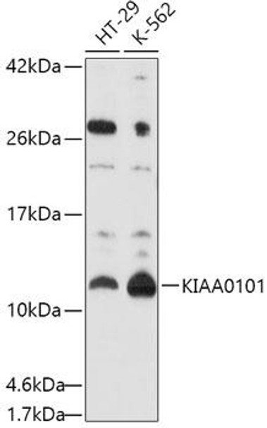 Anti-KIAA0101 Antibody (CAB10357)