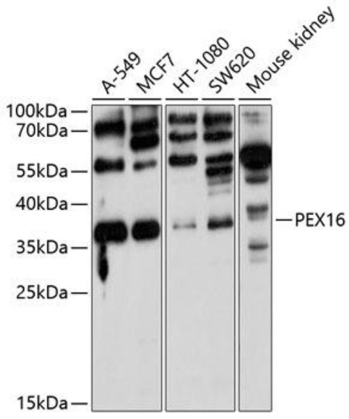 Anti-PEX16 Antibody (CAB10387)