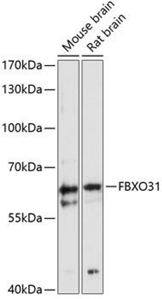 Anti-FBXO31 Antibody (CAB12888)