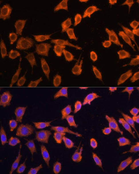 Anti-DRP1 Antibody (CAB16661)