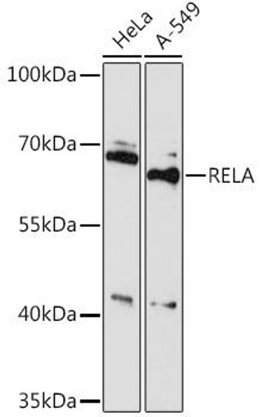 Anti-RELA Antibody (CAB16728)