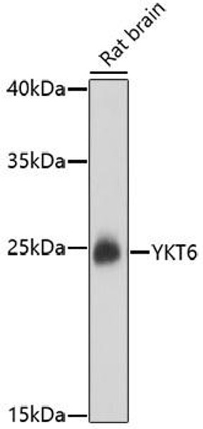 Anti-YKT6 Antibody (CAB17083)