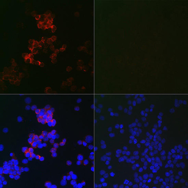 Anti-MAP1LC3B Mouse Monoclonal Antibody (CAB17424)