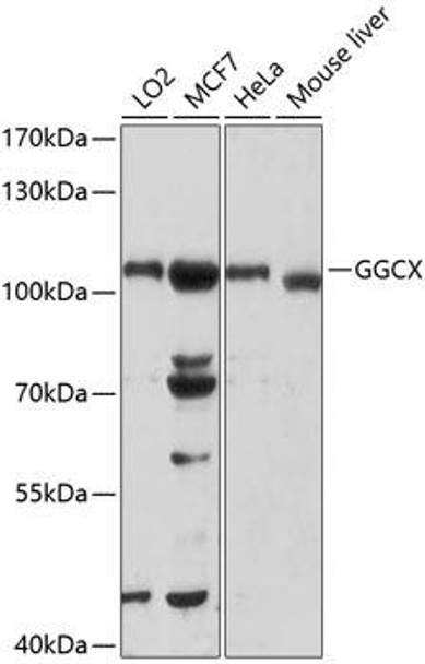 Anti-GGCX Antibody (CAB1806)