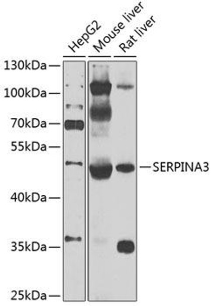 Anti-SERPINA3 Antibody (CAB2803)