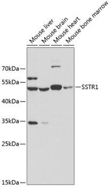 Anti-SSTR1 Antibody (CAB3134)