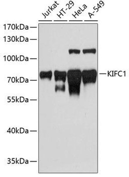 Anti-KIFC1 Antibody (CAB3304)