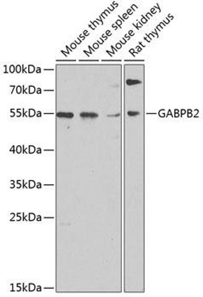 Anti-GABPB2 Antibody (CAB3543)