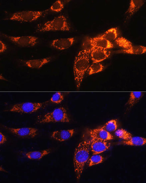 Anti-AMPD1 Antibody (CAB3584)