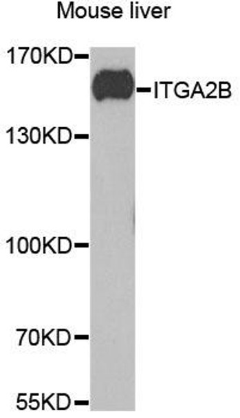 Anti-ITGA2B Antibody (CAB5680)