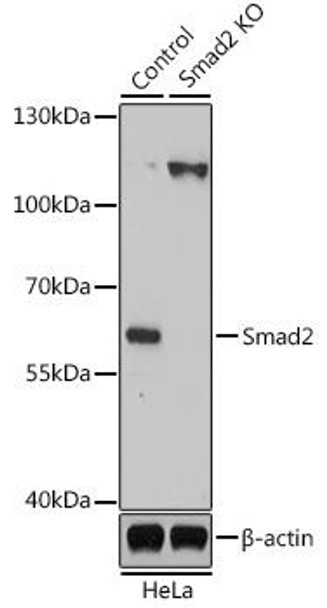 Anti-Smad2 Antibody (CAB7699)[KO Validated]