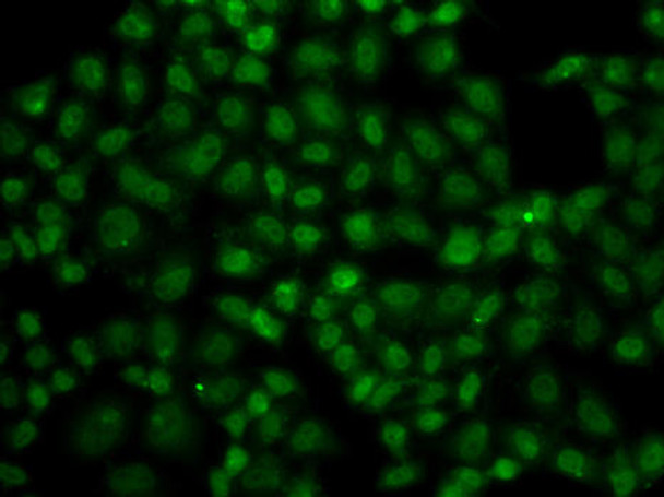 Anti-USP26 Antibody (CAB7999)