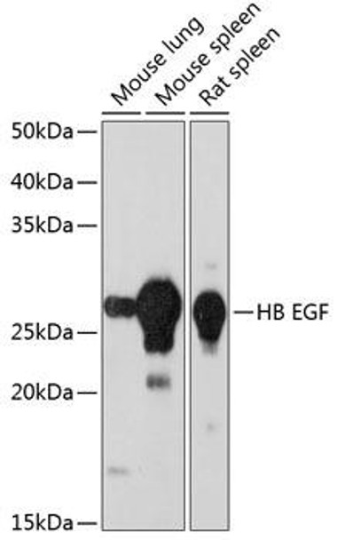 Anti-HB EGF[KO Validated] Antibody (CAB11657)