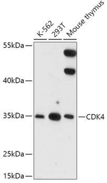 Anti-CDK4 Antibody (CAB16813)