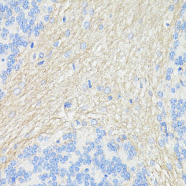 Anti-THY1 Antibody (CAB16986)