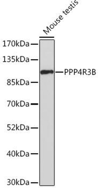 Anti-PPP4R3B Antibody (CAB17189)