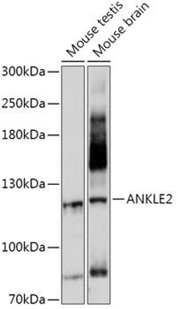 Anti-ANKLE2 Antibody (CAB17655)