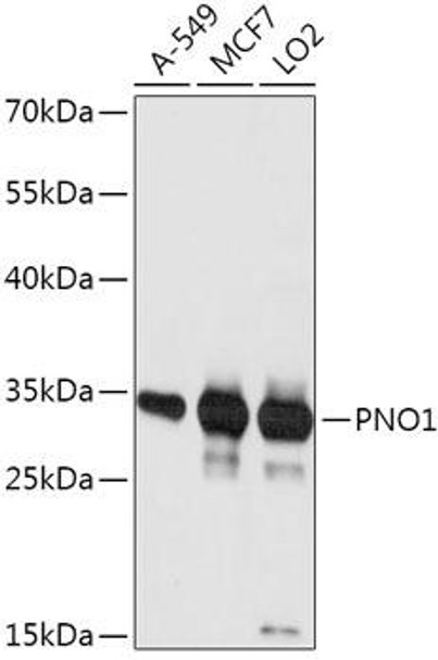 Anti-PNO1 Antibody (CAB17736)