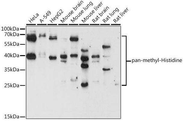 Anti-pan-methyl-Histidine Antibody (CAB17948)