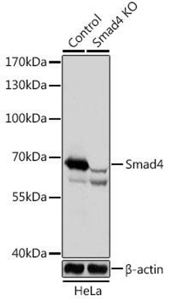 Anti-Smad4 Antibody (CAB18078)[KO Validated]